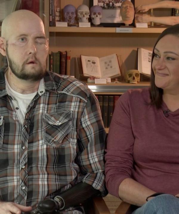 Mr James, pictured here with his wife Megan, says he hopes surgeons 'can learn something to help the next person' (Picture: AP)