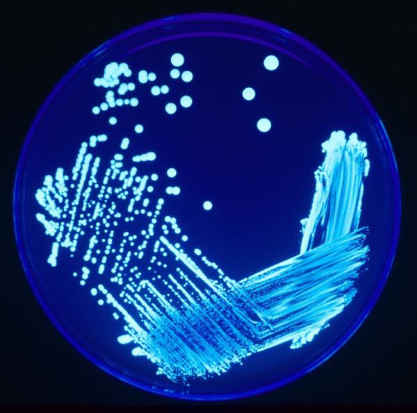 The bacteria live in freshwater enviro<em></em>nments and can become a health co<em></em>ncern when it grows and spreads in human-made building water systems.