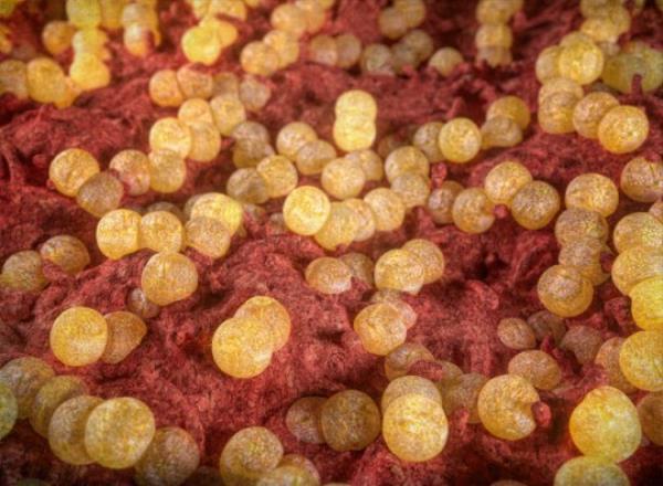A new antibiotic, zoliflodacin, has been found to cure even antibiotic-resistant infections 