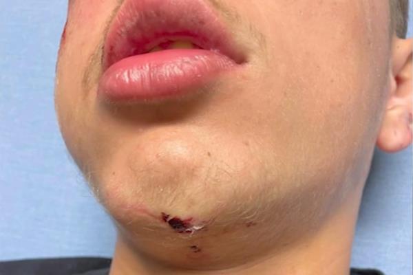 Walters was charged with Deprivation of Civil Rights after 