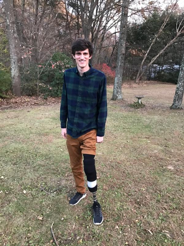 A photo of Co<em></em>nnor Golden outside smiling and looking at the camera with his prosthetic left leg.