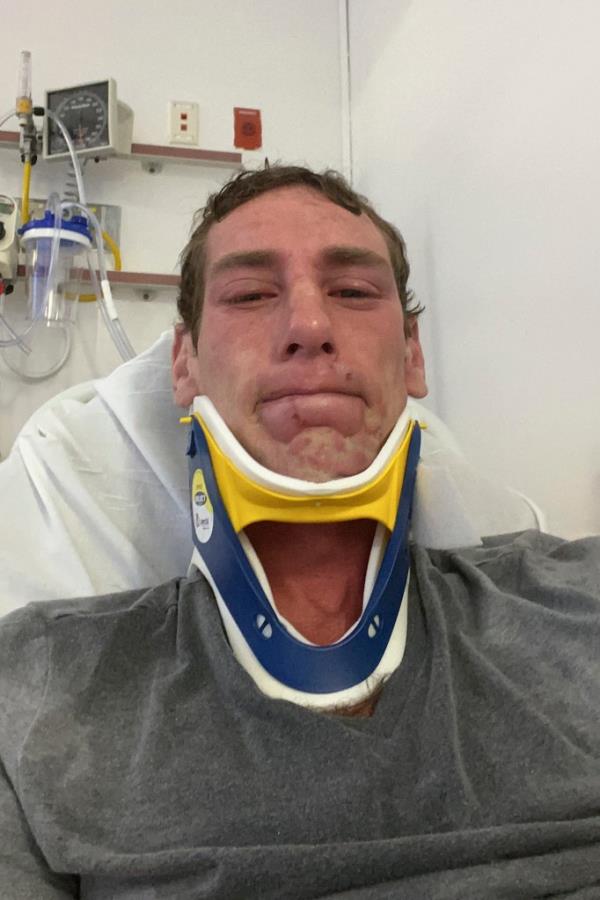 Borgen has said that he still suffers from post-traumatic stress disorder and wrist pain from the attack.